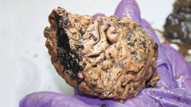 Pedaço de cérebro humano permanece intacto após 2,6 mil anos