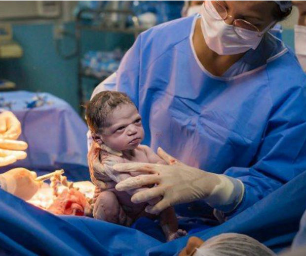 Bebê com expressão ‘zangada’ após nascer vira meme na web
