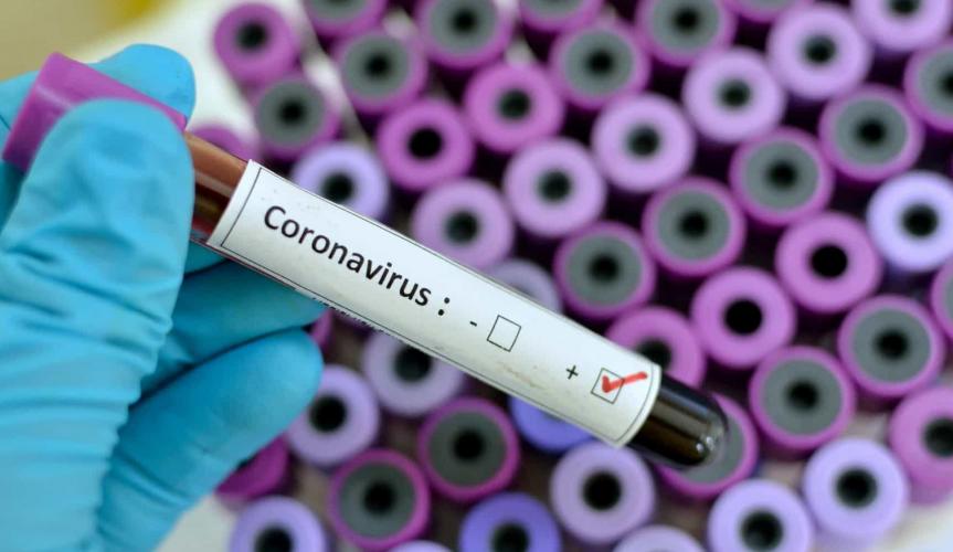 Brasil registra 488 casos suspeitos do novo coronavírus