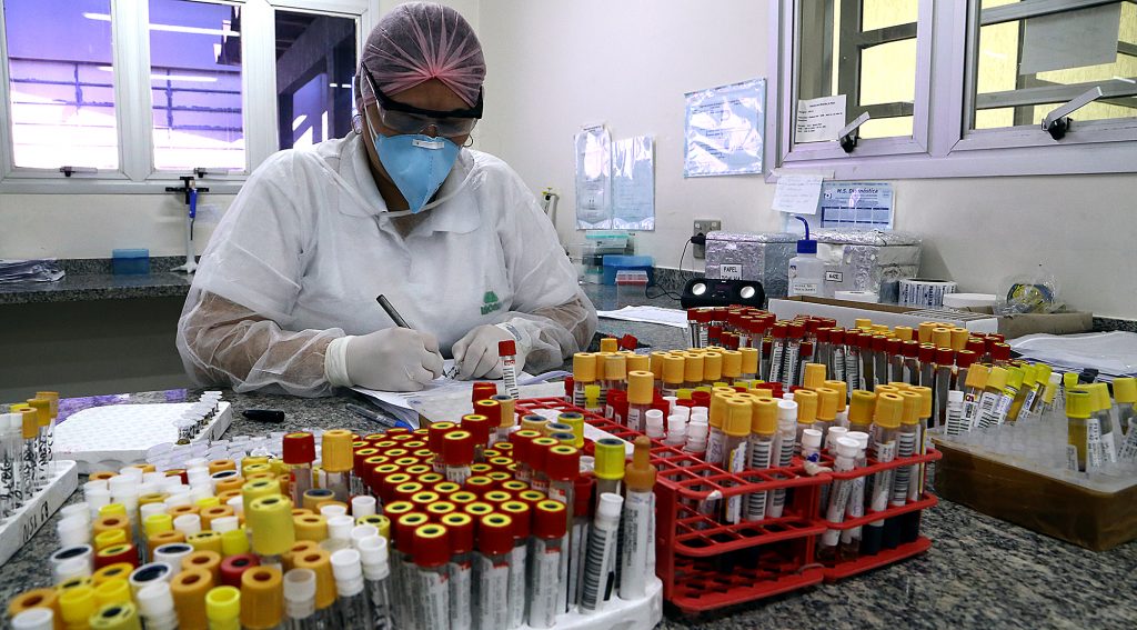Laboratórios, drogarias e farmácias são obrigadas notificar casos suspeitos e testados de Coronavírus à SES