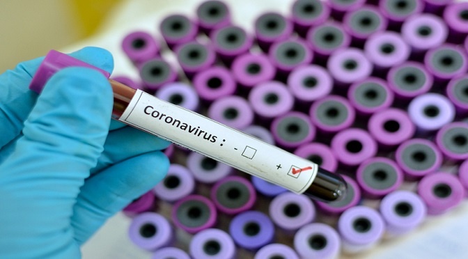 Mato Grosso do Sul tem 128 mortes por coronavírus e 10.687 confirmados