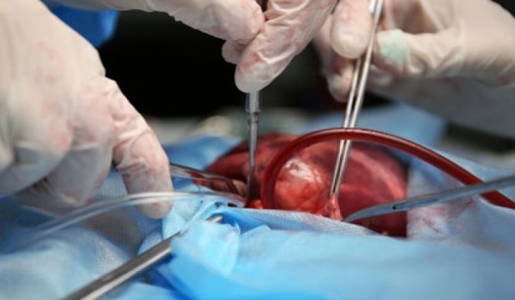 Cem sul-mato-grossenses renasceram com transplante de órgãos em 2020 e Setembro Verde sensibiliza para o tema