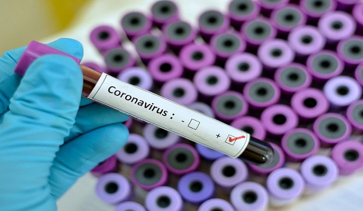 Saúde confirma mais 1.522 infectados e casos ativos de Covid passam de 12 mil