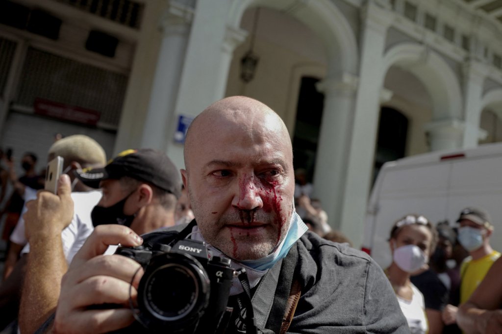 Fotógrafo agredido pela polícia durante protestos em Cuba é hospitalizado
