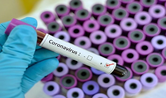 Preocupante: Boletim semanal contabiliza mais 20 mortes por Covid-19 em MS