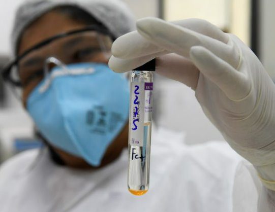 Com prática inovadora, Lacen passará a fazer sequenciamento genômico da turberculose em MS
